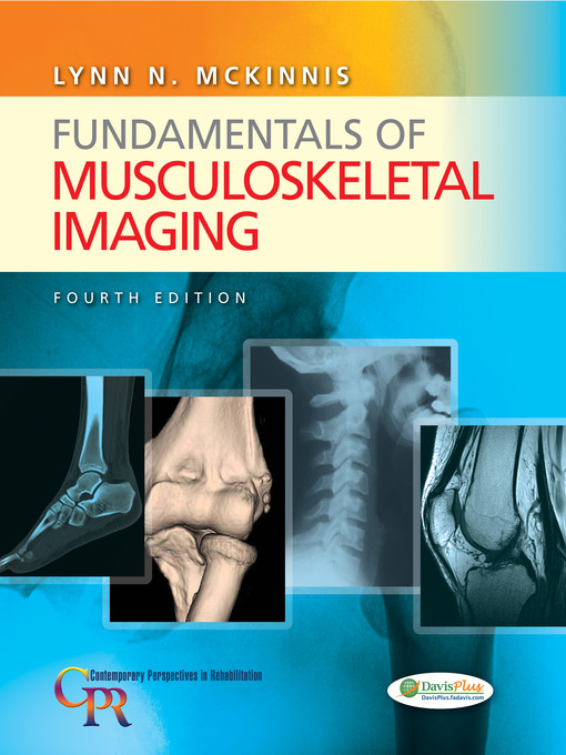Cover image for Fundamentals of Musculoskeletal Imaging